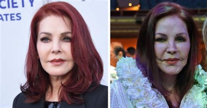 Plastic Surgery, Fame, And Beyond